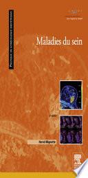 Maladies du sein