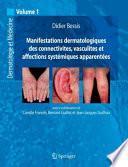 Manifestations dermatologiques des connectivites, vasculites et affections systémiques apparentées