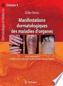 Manifestations dermatologiques des maladies d'organes