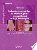 Manifestations dermatologiques des maladies du système hématopoïétique et oncologie dermatologique