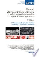 Manuel d'implantologie clinique. 3e édition - Editions CdP