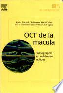 OCT de la macula