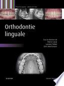Orthodontie linguale