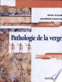 Pathologie de la verge