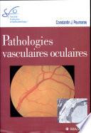 Pathologies vasculaires oculaires