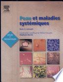 Peau et maladies systémiques