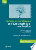 Principes et protocoles en neuroanesthésie
