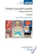 Prothèse amovible partielle. 2e édition - Editions CdP