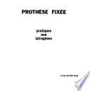 Prothèse fixée