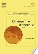 Rétinopathie diabétique