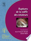 Ruptures de la coiffe des rotateurs