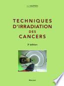 Techniques d'irradiation des cancers