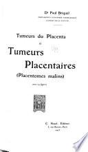 Tumeurs du placenta et tumeurs placentaires (placentomes malins)