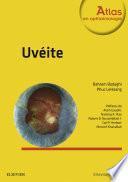 Uvéite